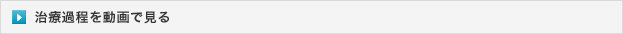 治療過程動画を見る
